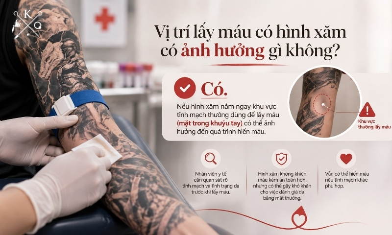 Vị trí hình xăm có thể ảnh hưởng đến việc lấy máu