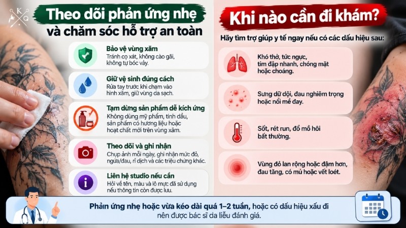 Các bước chăm sóc ban đầu khi nghi dị ứng mực xăm