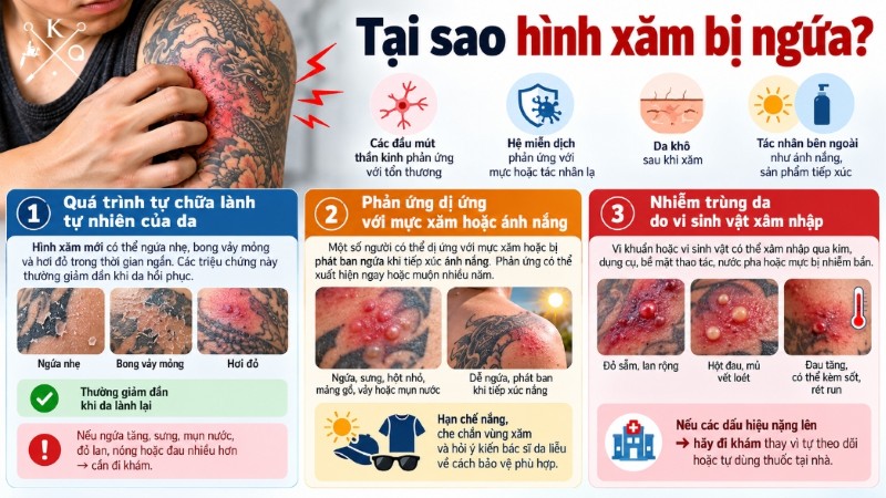 Các nguyên nhân khiến hình xăm bị ngứa sau khi xăm