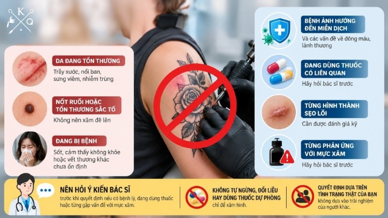 Các trường hợp nên hoãn xăm để bảo vệ sức khỏe làn da