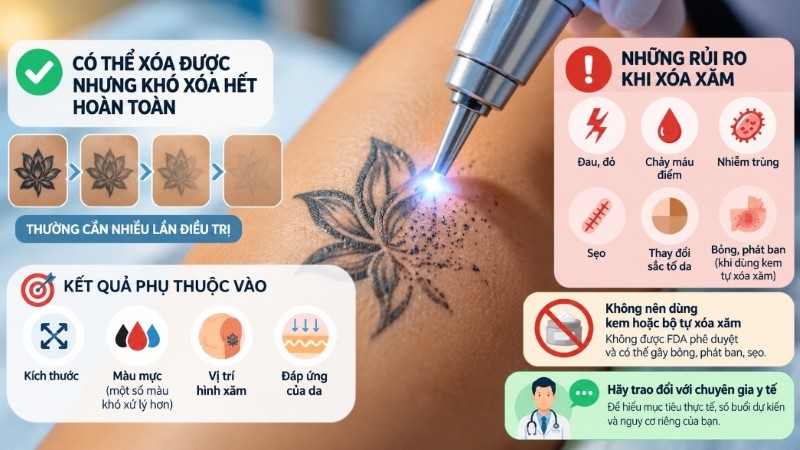 Các yếu tố ảnh hưởng đến khả năng xóa hình xăm