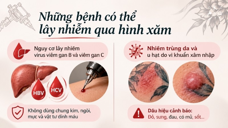 Các nguy cơ nhiễm trùng liên quan đến dụng cụ và mực xăm không bảo đảm vệ sinh Các nguy cơ nhiễm trùng liên quan đến dụng cụ và mực xăm không bảo đảm vệ sinh